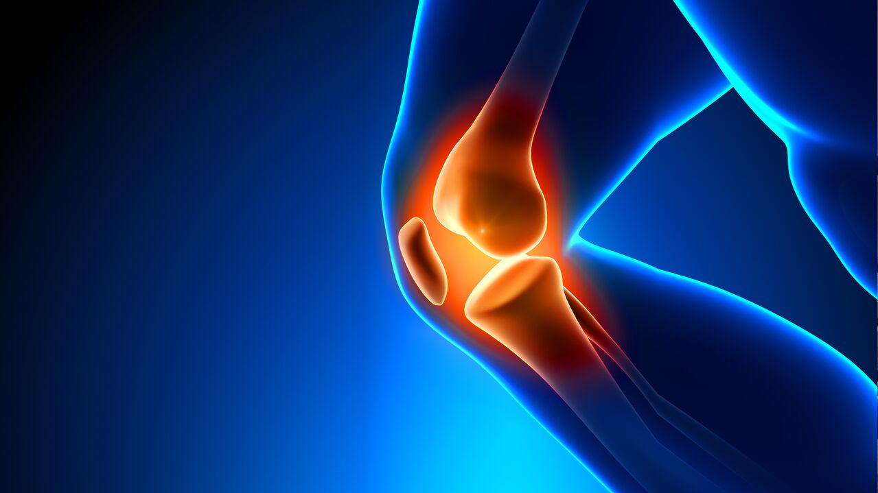 arthrosis of the joints